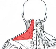 Shoulder Bursitis, Tight Shoulders, Stiff Neck, Myofascial Release, Mobility Exercises, Shoulder Pain, Sciatica