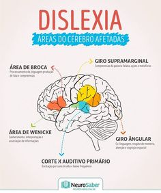 the brain and its functions are labeled in spanish