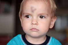 A parents guide to child head injuries  #health #kids #baby #headinjury #guide Bump On Head, Hitting Toddler, Hit Head, Shaving Cut, Head Injuries, Head Bump, Terrible Twos, Kids Head, Toddler Fall