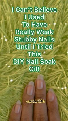 Strong Nails Diy, Fingernail Health, Grow Long Nails, Nail Remedies, Nail Growth Tips, Natural Nail Care, Nail Care Tips, Nail Care Routine, How To Grow Nails