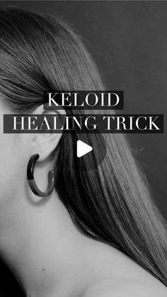 Madame Sweat on Instagram: "Keloid healing hack #keloid #keloids #keloidtreatment #hacksandtips #diyhacks #earpiercing #asprin #healingtips #madamesweat #madamesweatisconcerned #madamesweatkaianaturals #kaianaturals" How To Heal Keloids On Piercings, How To Get Rid Of Keloids On Ear, Keloids Ear Piercing, Keloids Home Remedies, Get Rid Of Keloids, Raw Turmeric, Ear Pressure, Cute Piercings, Workout Machines