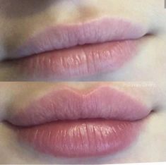 Female Reference, Brand Color Palette, Cosmetic Procedures, Lip Plumper