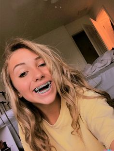 Powerchain Braces Colors Pink, Blue Braces Aesthetic, Braces Aesthetic Girl, Baddies With Braces, Braces Selfie, Light Blue Braces, Girl With Braces, Braces Colors Combinations