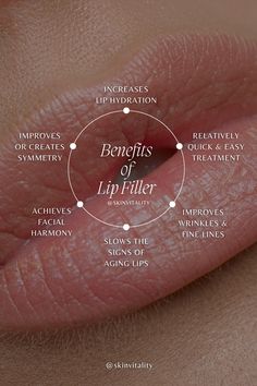 💋🌟Revitalize, Rejuvenate, Rebalance your lips: The Real Deal About Dermal Fillers! ❤️ Call (877) 346-6926 to book your appointment with a regulated Healthcare Professional 👨‍⚕️⚕️ Helping the most people look and feel beautiful in Canada since 1992 🖤 • • • • #juvederm #juvedermcanada #bodytransformation #dermalfiller #lipfiller #facialaesthetics #antiaging #nurseinjector #botoxtoronto #chinfiller #jawlinefiller #fillernearme #lipflip #lipfillertoronto Lip Filler Social Media, Botox Education, Lip Filler Quotes, Lip Filler Aesthetic, Medspa Aesthetic, Glossy Aesthetic, Fillers Aesthetic, Botox Quotes, Filler Aesthetic