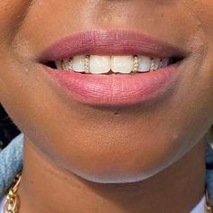 Tooth Caps, Look Hip Hop, Teeth Covers, Teeth Caps, Grills Teeth, Tooth Gem, Teeth Jewelry, Vertical Bar, Hot Jewelry