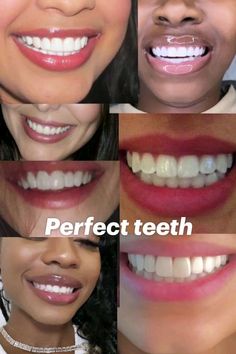 Perfect White Teeth, Mint Toothpaste, Perfect Teeth, Teeth Braces, Smile Teeth