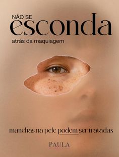 Não se esconda atrás da maquiagem por causa das manchas! ✨ Existem tratamentos eficazes como peeling químico, laser, microagulhamento e luz pulsada que podem devolver a uniformidade e o brilho natural da sua pele. Liberte-se dos filtros e da base pesada – comece hoje sua jornada para uma pele mais saudável e confiante. Doctor Logo, Doctor Logos, Bellini, New Job, Dark Spots, Skin Care Tips, Healthy Skin, Sensitive Skin, Black Women