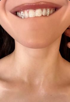 a woman with braces on her teeth smiling