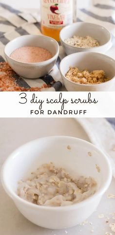 Scalp Scrub For Dandruff, Diy Scalp Scrub, Diy Hair Scrub, What Causes Dandruff, Our Oily House, Hair Mask For Dandruff, Exfoliate Scalp, Hair Detox, Dandruff Remedy