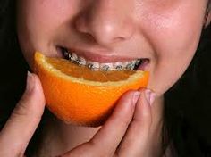 If one of your wires or brackets breaks, don't panic. Don't try to bend the wire or pull it out, which could make things worse. Just cover any sharp edges with wax, and call your orthodontist as soon as possible. - #abbotsford #orthodontics #braces Braces Friendly Recipes, Rice And Corn, Invisible Braces, Heal Cavities, Brace Face