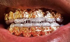 Custom Grillz, made to order. Handmade just for you. Don't settle for imitators, we are a full service jewelry store. 6 or 12 pc Customized in Gold Plated Silver or Genuine Gold. Please add top or bottom in the notes if you are ordering 6. 12 piece is considered a 6 top & 6 bottom set. Please choose the desired number of teeth and metal purity. Make sure to see our other listing for lots of other designs and configurations. AVAILABLE IN: Yellow Silver(Gold over Silver) or 8K/ 10K/ 14K GOLD! Custom Gold Iced Out Jewelry, Rose Gold Iced Out Jewelry For Gift, Rose Gold Iced Out Jewelry As Gift, Luxury Iced Out Rose Gold Jewelry, Luxury Iced Out Jewelry For Wedding, Yellow Gold Plated Bling Jewelry, Yellow Gold 14k Bling Jewelry, 14k White Gold Iced Out Jewelry, 14k Yellow Gold Jewelry With Bling