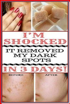 It Removed My Dark Spots  - and Made my Skin Clearer by daycredex daycredex | This newsletter was created with Smore, an online tool for creating beautiful newsletters for educators, businesses and more