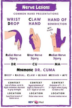 Hand Occupational Therapy, Neuro Occupational Therapy, Physical Therapy Student Study, Punkty Spustowe, Pt School, Studie Hacks, Radial Nerve