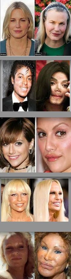 Plastic Surgery Fails, Moral Of The Story