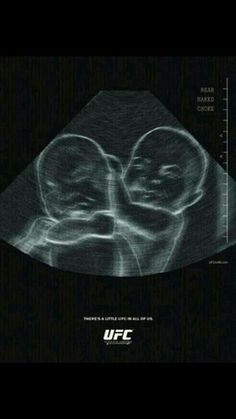 an x - ray image of two people in the middle of a black and white photo