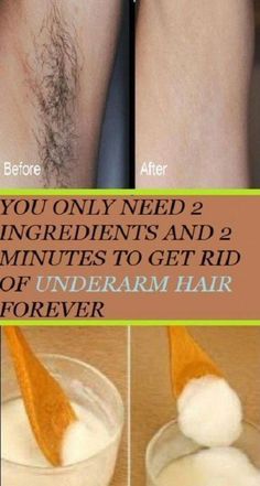 Best Permanent Hair Removal, Permanent Hair Removal Cream, Chin Hair Removal, Electrolysis Hair Removal, Unwanted Hair Permanently, Remove Unwanted Facial Hair, Unwanted Hair Growth, Underarm Hair Removal