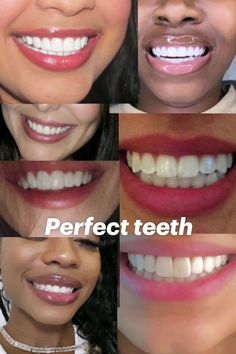 Perfect White Teeth, Teeth Aesthetic, Pretty Teeth, Mint Toothpaste, Beautiful Teeth, Perfect Teeth, Teeth Braces, Smile Teeth, Manifesting Vision Board