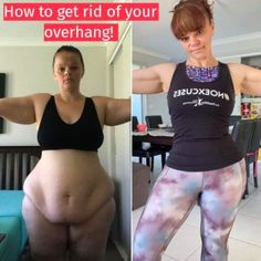 You don’t have to do endless crunches to get rid of your tummy overhang! Belinda is PROOF. How To Shrink Hanging Belly, Belly Overhang Get Rid Of, Overhang Belly Exercise, Apron Stomach Workout, Apron Stomach How To Get Rid, How To Get Rid Of Belly Overhang, Apron Exercises, Stomach Overhang Exercise, Apron Tummy Workout