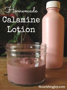 Homemade Calamine Lotion, Calamine Lotion, Natural Diy, Natural Health Remedies