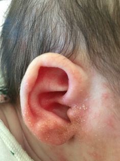 a close up of a baby's ear and head