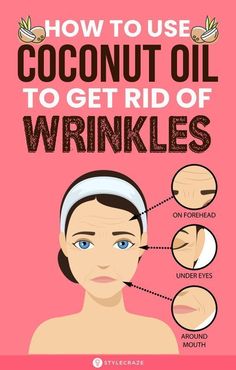 How To Use Coconut Oil To Get Rid Of Wrinkles: Though there are various cosmetic treatments to reduce wrinkles, coconut oil is the safest way to go. It boosts the production of collagen and encourages the regeneration of cells in your skin. It effectively fades away wrinkles and makes your skin taut. #wrinkles #coconutoil #skincare #skincaretips #beauty #beautytips Wrinkles Remedies Face, Camouflage Makeup, Get Rid Of Wrinkles, Wrinkle Remedies, Ootd Instagram, Skin Care Wrinkles, Baking Soda Shampoo, Coconut Oil For Skin, Face Wrinkles