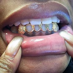 Bottom Grills For Black Women, Bottom Grillz For Women, Girl Grills, Grills For Women, Girls With Grills, Gold Grills, Girl Grillz, Bottom Grillz, Teeth Gems