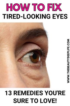 Eye Wrinkles Remedies, Tired Looking Eyes, Undereye Bags Remedy, Wrinkle Remedies, Mind Diet, Tips Skincare