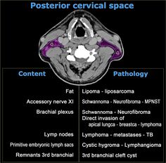 an mri scan shows the location of the posterior crevical space and its corresponding parts