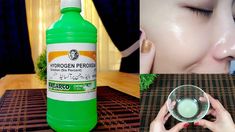 Hydrogen Peroxide Uses For Skin, Baking Soda Hair Lightener, Ways To Remove Blackheads, Bleaching Dark Hair, Hydrogen Peroxide Skin, Whiten Teeth Fast, Blackheads And Whiteheads, Peroxide Uses, Hydrogen Peroxide Uses