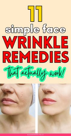 Ready to say goodbye to fine lines? These 11 diy wrinkles remedies will help you prevent wrinkles and keep your skin looking fresh! From home remedies for wrinkles to oils and massages, we’ve got all the wrinkle remedies face tricks you need. Check out the blog for the best anti aging tips and maintain your wrinkles skin care routine effortlessly! Remedies For Wrinkles On Face, Face Exercises For Wrinkles Anti Aging, Best Anti Wrinkle Products, Skin Care Routine For Wrinkles, Anise For Wrinkles, Vaseline Uses For Face Wrinkles, Makeup With Wrinkles, Creepy Skin Remedies, Reduce Wrinkles On Face