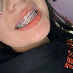 Gigi Behel, Purple Braces, Behel Gigi, Teeth Aesthetic