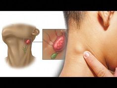 7 easy ways to quickly unclog your lymph nodes to reduce Swelling And Flush Out Toxins**Subscribe Chanel :   https://goo.gl/yDDDL2 -He who has health, has ho... Face Massage Anti Aging, Flush Out Toxins, Throbbing Headache, Natural Face Cleanser, Slimmer Face, Women Health Care, Organic Remedy, Healthy Advice