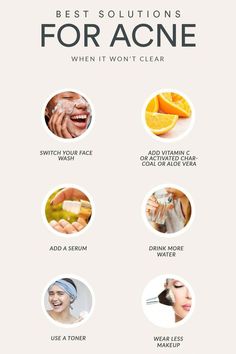 Wow Skin Science, Blind Pimple, Forehead Acne, Pimples Under The Skin, Prevent Pimples, Vegan Hair Care, Acne Skincare Routine, How To Get Rid Of Pimples