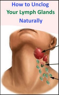 Lymph Glands, Calendula Benefits, Lymph Massage, Lymph Drainage, Coconut Health Benefits, Natural Health Remedies, Health Info, Natural Medicine