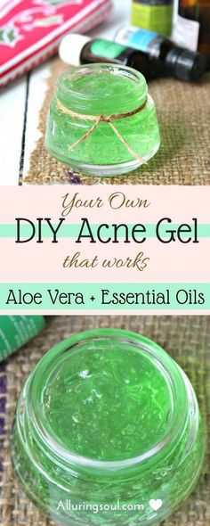 Opt permanent solution by giving natural blessing to your skin. DIY acne gel is made up of essential oils which is main ingredient that will really works. Facial Remedies, Joululahjat Diy, Painful Acne, Make Up Diy, Make Up Foundation, Acne Gel, Diy Acne, Natural Beauty Care, Brown Spots Removal