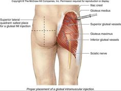 the muscles are labeled in this diagram