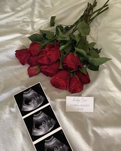 roses and an x - ray are on the bed with a card for someone to write their name