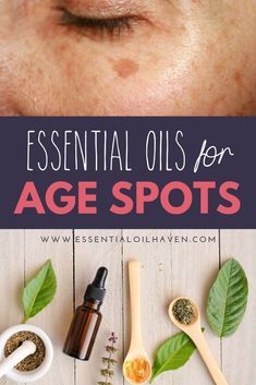 Age Spots Essential Oils, Essential Oils For Age Spots, Serum Recipe, Age Spots On Face, Diy Serum, Essential Oils For Face, Carne Guisada, Lavender Rosemary, Oil Remedies