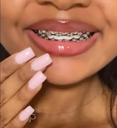 Black braces Braces Black Bands, Braces Colors On Dark Skin, Black Braces Color, Pink And Black Braces, Smiley Piercing With Braces