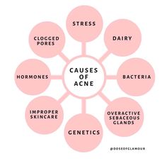 Cause Of Acne, Causes Of Acne, Esthetician Quotes