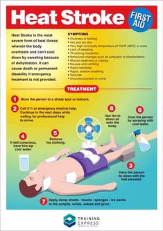 First Aid Poster, Medical Jokes, Medical Mnemonics, Medical Brochure, First Aid Tips, Safety Poster, Heat Exhaustion, Safety Posters, Poster Shop