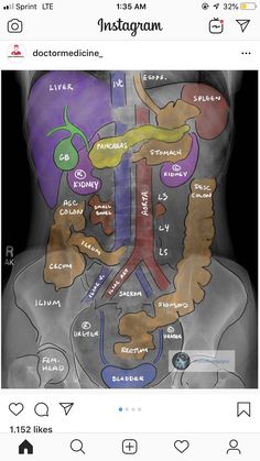 an x - ray shows the location of the stomach and its major organs, including the abdomen