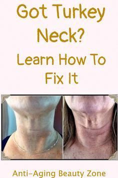 I hate a droopy turkey neck! See how I got rid of sagging neck skin without surgery or Botox! #HowMuchWalkIsNeededToLoseWeight Turkey Neck Exercises, Get Rid Of Turkey Neck, Sagging Neck Skin, Tighten Neck Skin, Sagging Cheeks, Saggy Neck, Neck Tightening, Sagging Neck