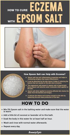 Eczema is an allergic reaction of the skin caused by external factors. It causes itching, causes rashes. here we discussing uses of Epsom salt for eczema Holistic Remedies, Natural Therapy, Natural Health Remedies, Epsom Salt, Natural Home Remedies, Shampoos, Health Remedies, Holistic Health