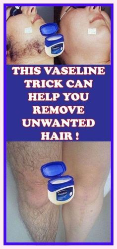 20 Amazing Uses of Vaseline (You’ve Probably Never Heard of!) Remove Unwanted Facial Hair, Remove Unwanted Hair, Unwanted Facial Hair, Hair Removal Methods, Facial Hair Removal, Hair Removal Permanent, Body Hair Removal