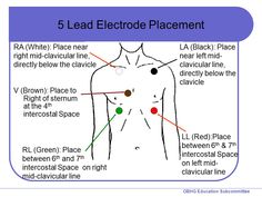 the diagram shows how to use an electric placement