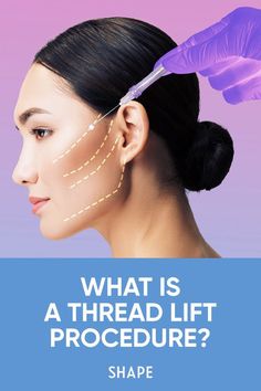 Face Tightening Procedures, Thread Lift Face, Face Threading, Facelift Procedure, Tighten Facial Skin, Face Tightening, Thread Lift, Facial Plastic Surgery, Tighten Skin