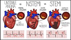 an image of the human heart and its functions in different ways, including blood vessels