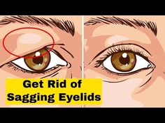 Saggy Eyes, Swollen Eyelid, Baggy Eyes, Hooded Eye Makeup Tutorial, Facial Massage Routine