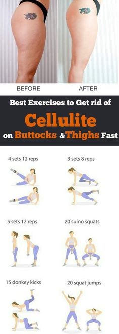 Best Exercises, Do Exercise, Burn Belly Fat, Fat Fast, Leg Workout, Lose Belly, Easy Workouts, Lose Belly Fat, Belly Fat